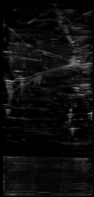 Ultrasound image with reverberation artifacts removed